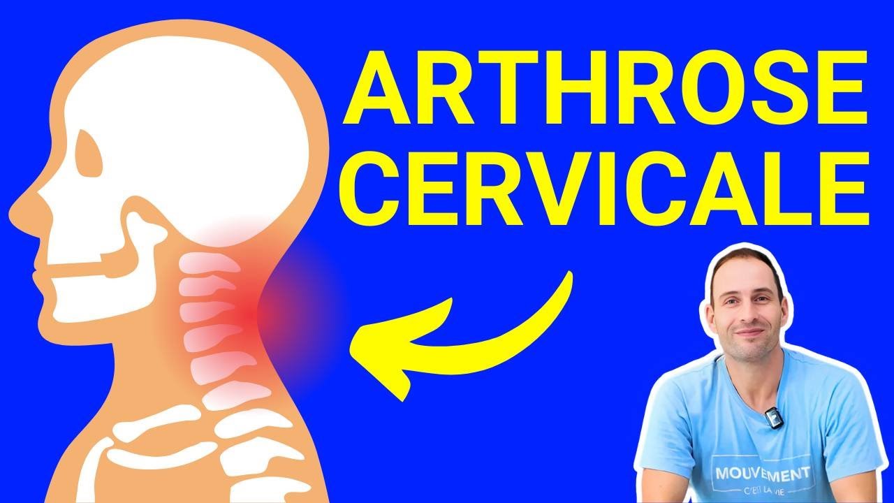 Arthrose cervicale : 4 exercices