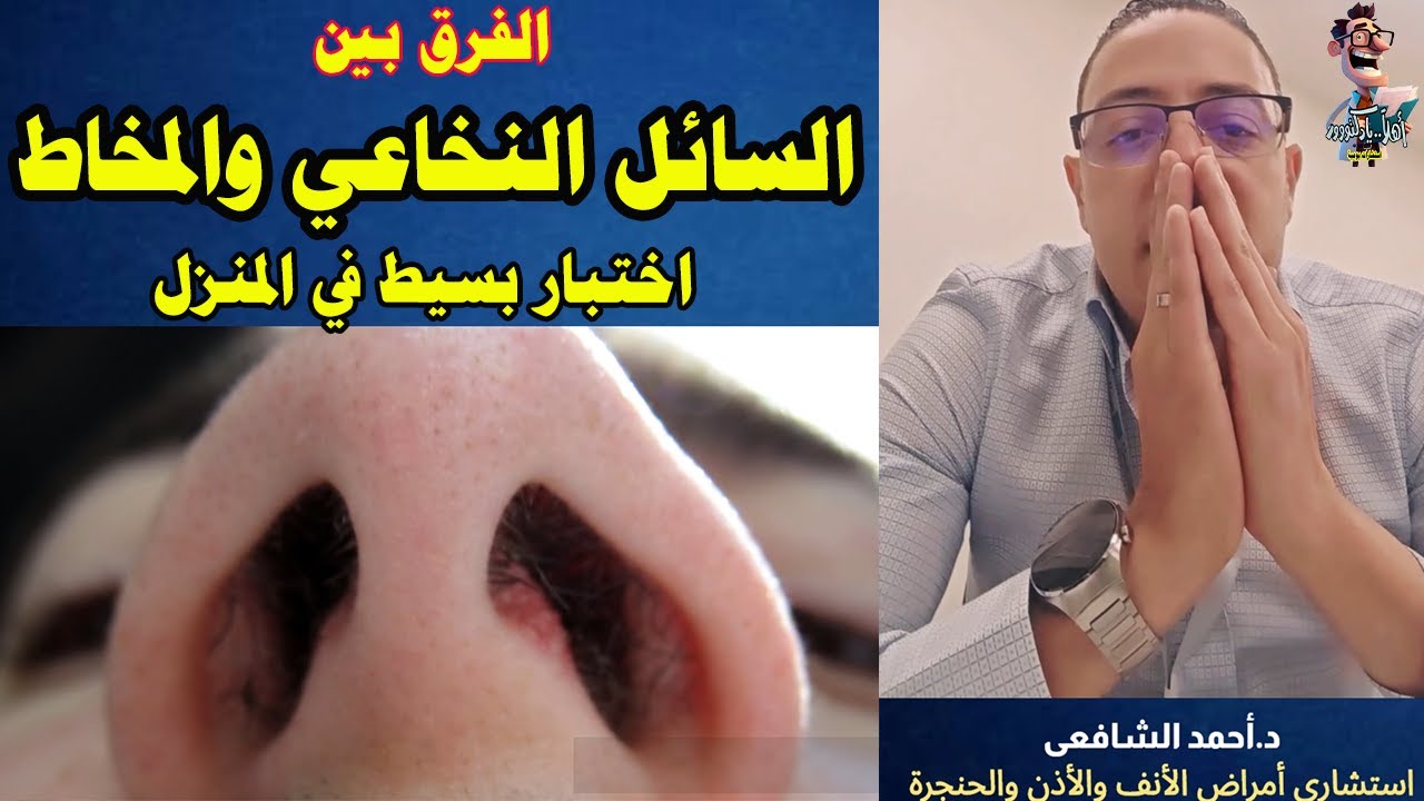 تسرب السائل النخاعي من الأنف اختبار منزلى يطمنك | اهلا يا دكتور امراض الأنف والأذن والحنجرة