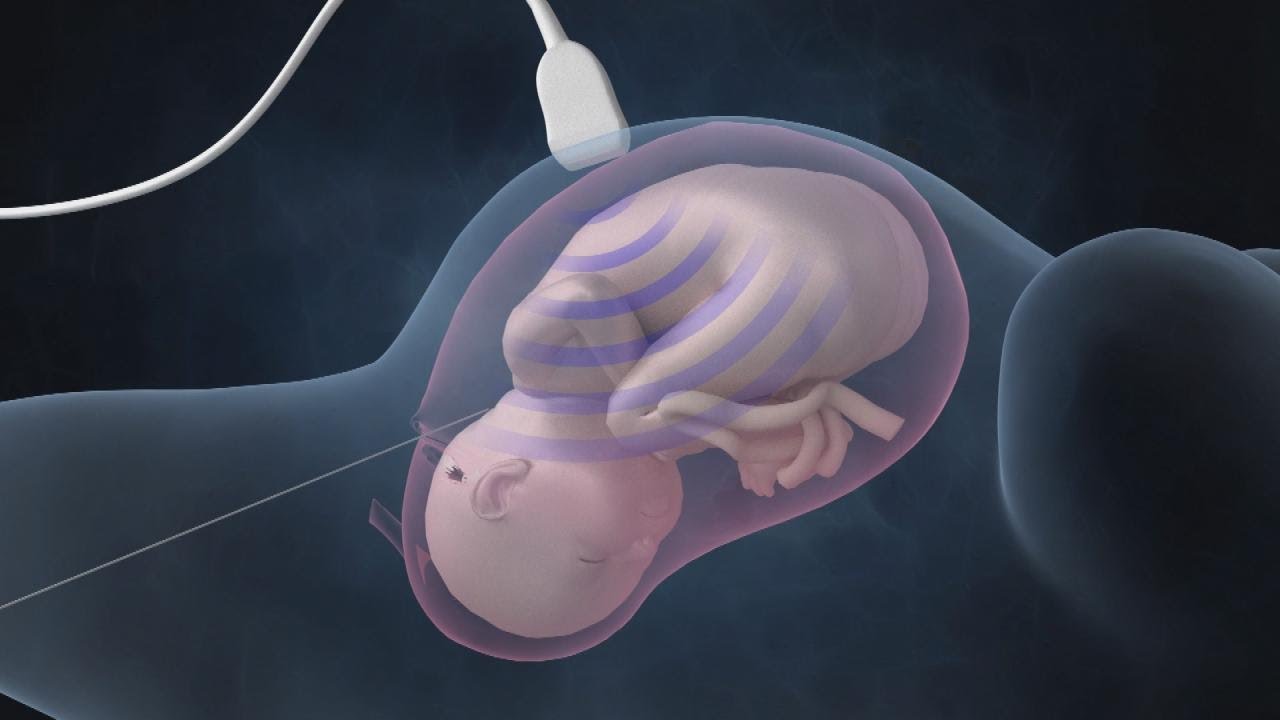 Inside Baby Lorenzo&rsquo;s Rare In-Utero Heart Surgery