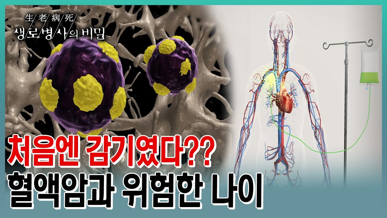 혈액암 환자에서 50대 이상이 76%나 될 정도로 위험한 건 나이. 조혈모세포 기증과 이식, 제대혈 이식 과정과 궁금증을 자세히 풀어본다 (KBS 20230510 방송)