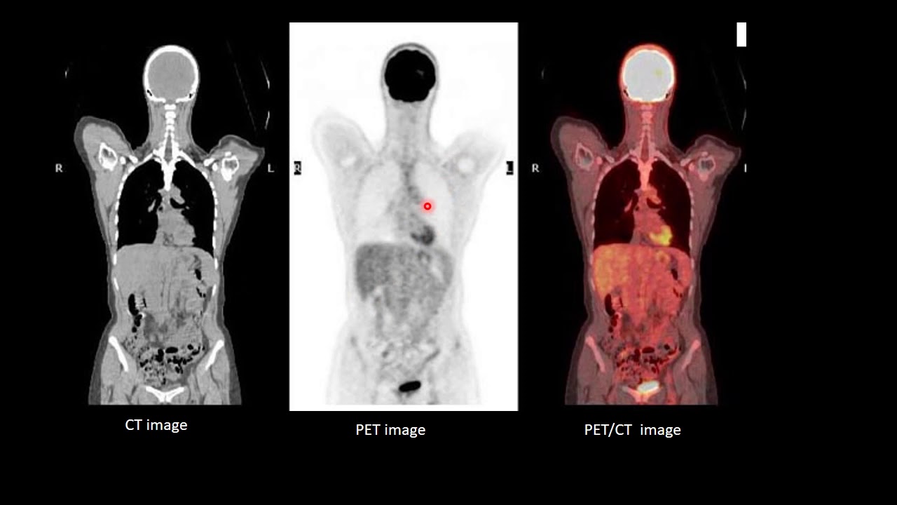 PETCT part 1 محاضرة د محمد العدلانى استاذ مساعد الاشعة التشخيصية