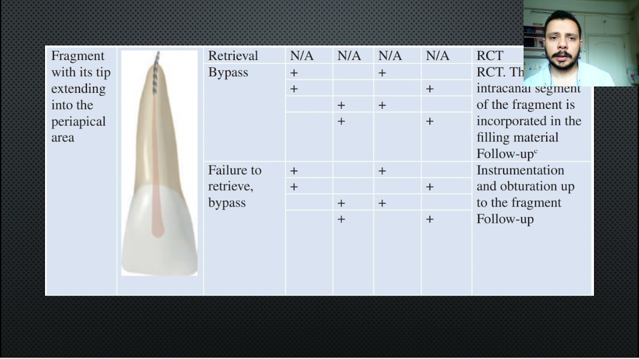 Tube technique for removing broken files. Dr Ahmad Arafeh