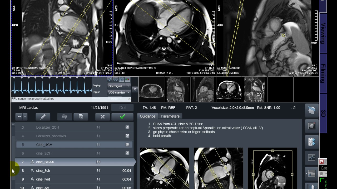 MRI Cardiac..... CMR