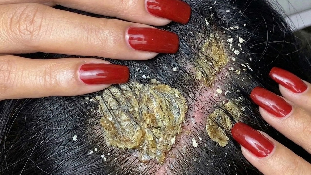 Hair Brushing & Scalp Scratching ASMR #KM0026