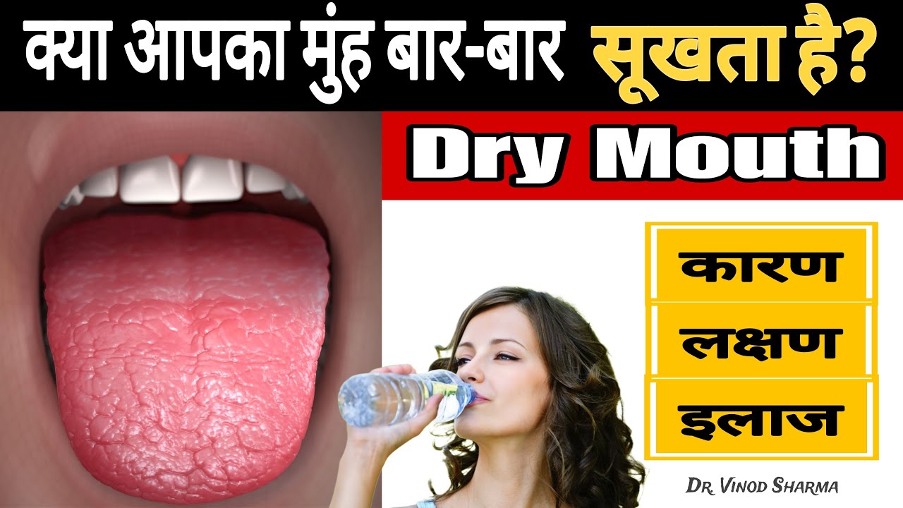 मुंह सूखना|गला सूखना|Dry Mouth किस बीमारी के कारण होता है?Dry Mouth: लक्षण, और इलाज|Sehat Ki Kunji