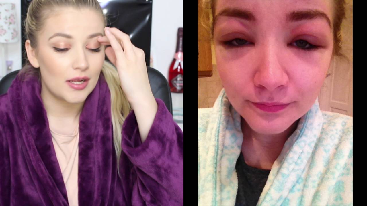 BENEFIT BROW DISASTER (ALLERGIC REACTION) | Luce Stephenson