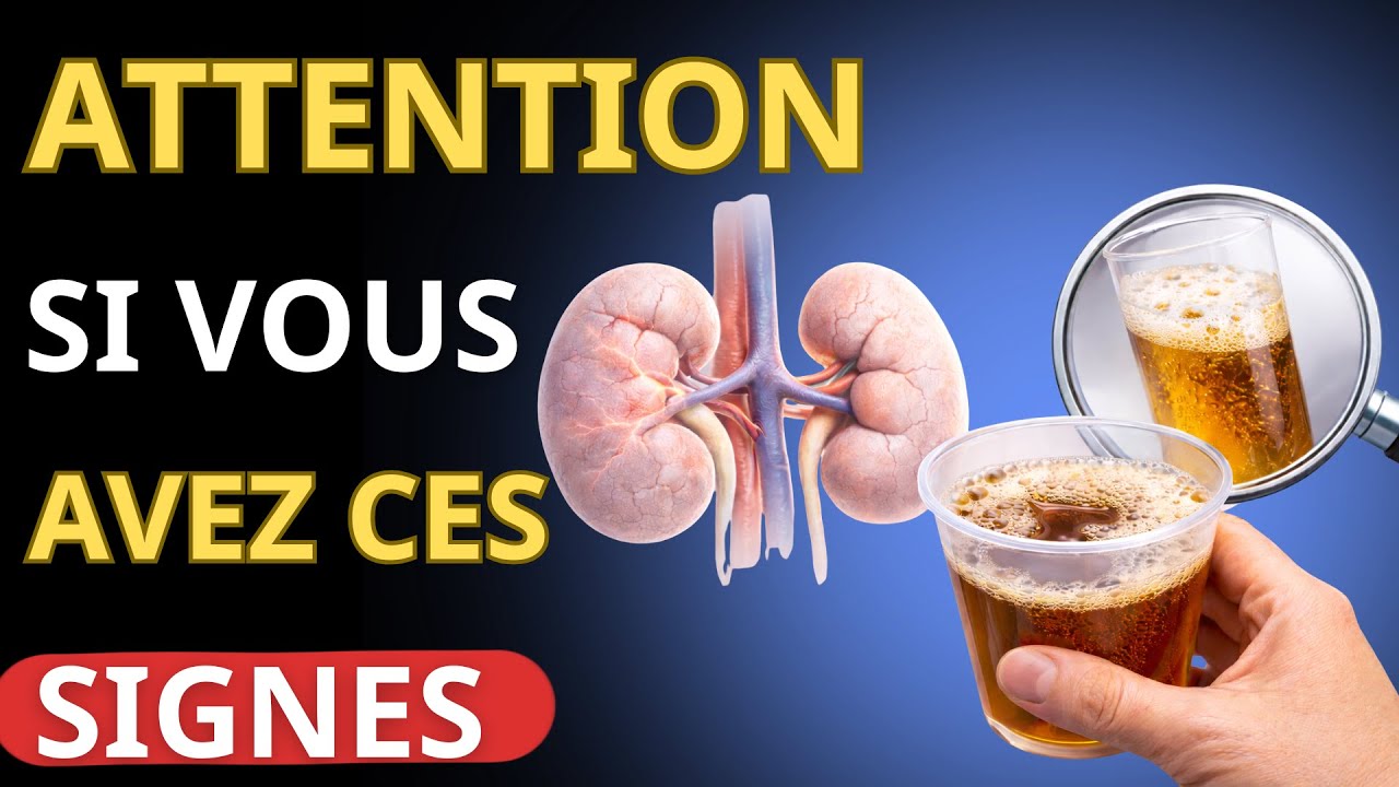 Urine foncée et mousseuse : Est-ce lié aux reins?