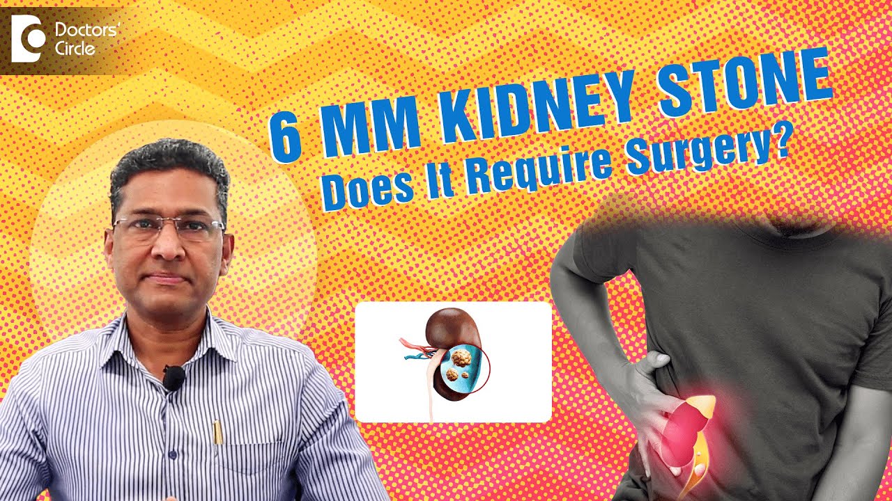 KIDNEY STONE Treatment for 4mm, 5mm, 6 mm | #kidneystone Treatment ESWL, RIRS - Dr. Girish Nelivigi