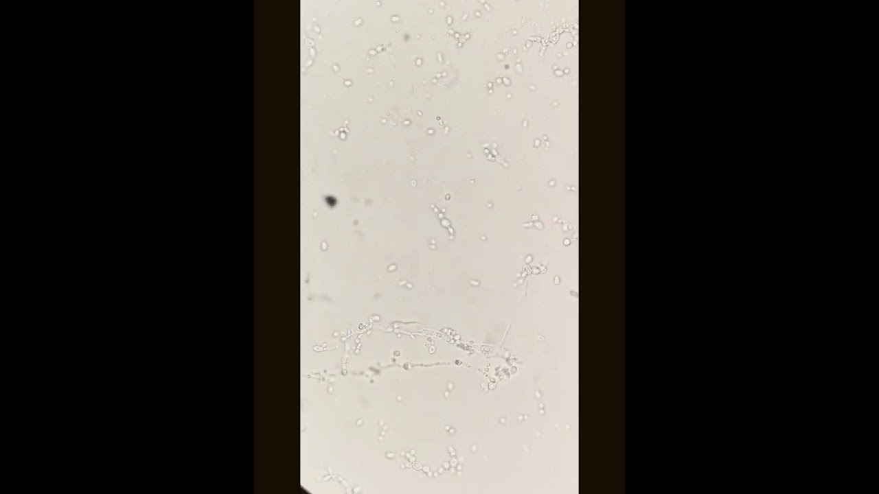 Fungal hyphae under the microscope #laboratory #microscope #mls #cls #fungi #yeastcells #spores