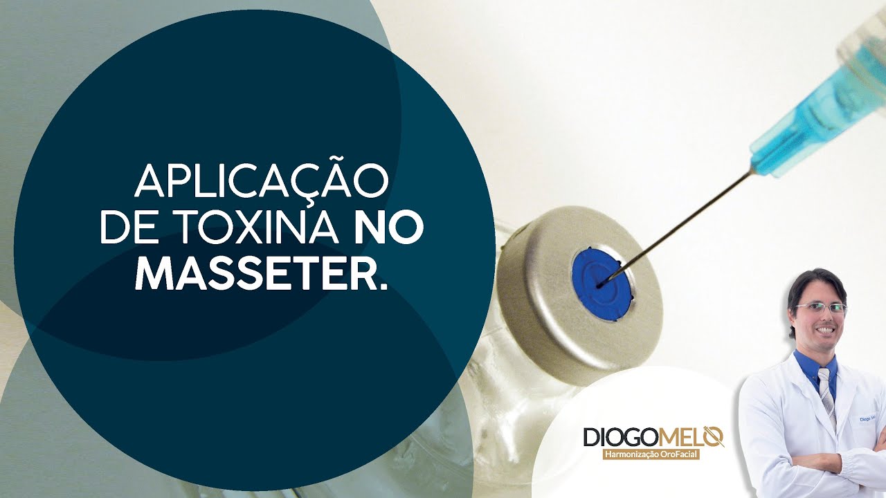 Aplicação de Toxina Botulínica no músculo masseter.