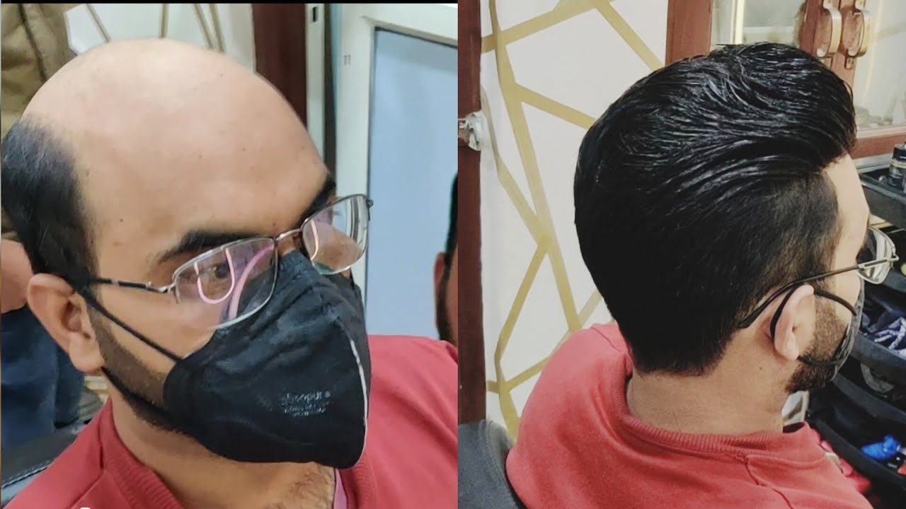 hair fixing Delhi Australian hair patch full back coming hair patch gilo method hair patch #video