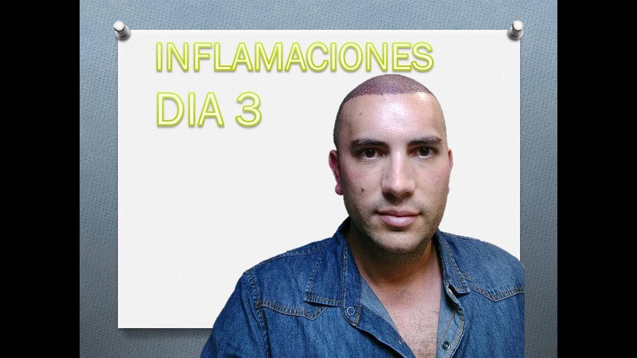INFLAMACIONES DESPUES DEL TRASPLANTE Y DÍA 3 [CAPITULO 7]
