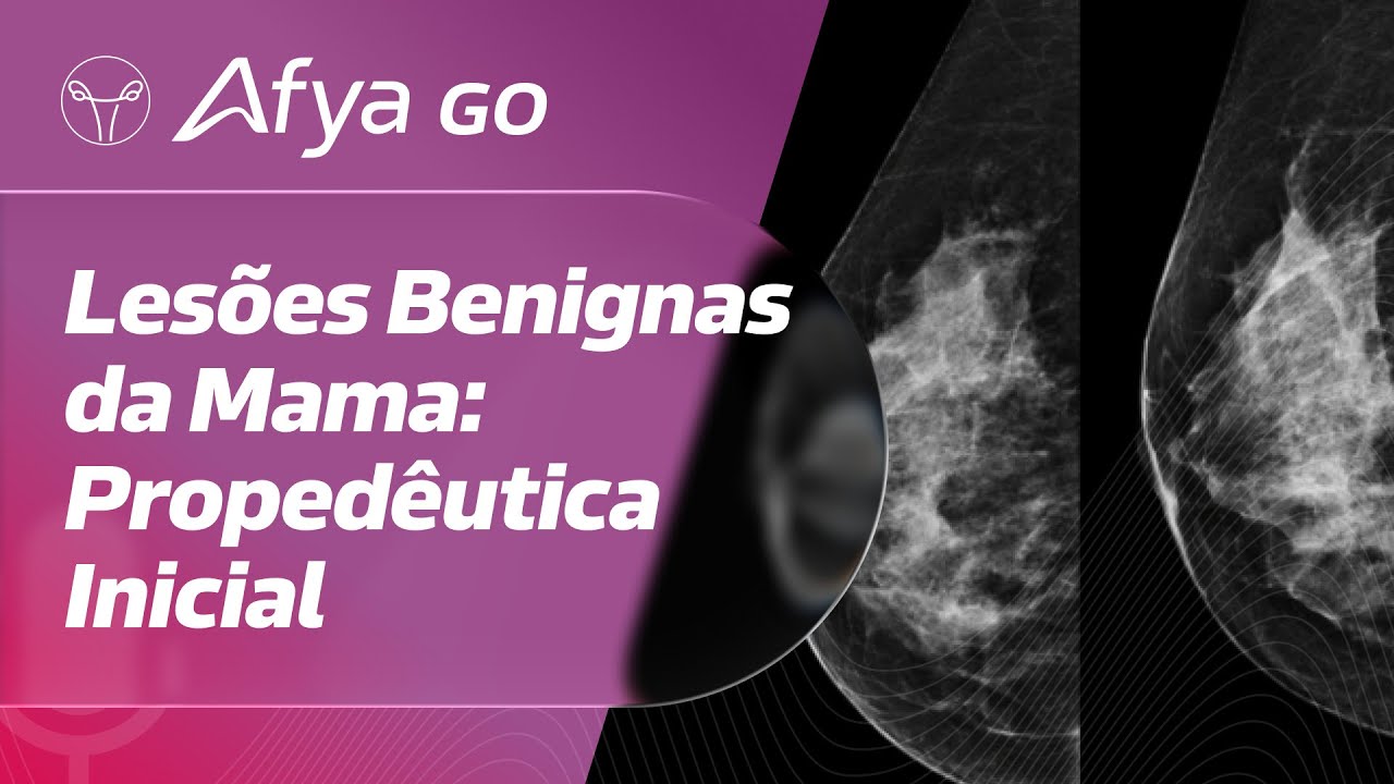 Como diferenciar as lesões benignas das malignas da mama?