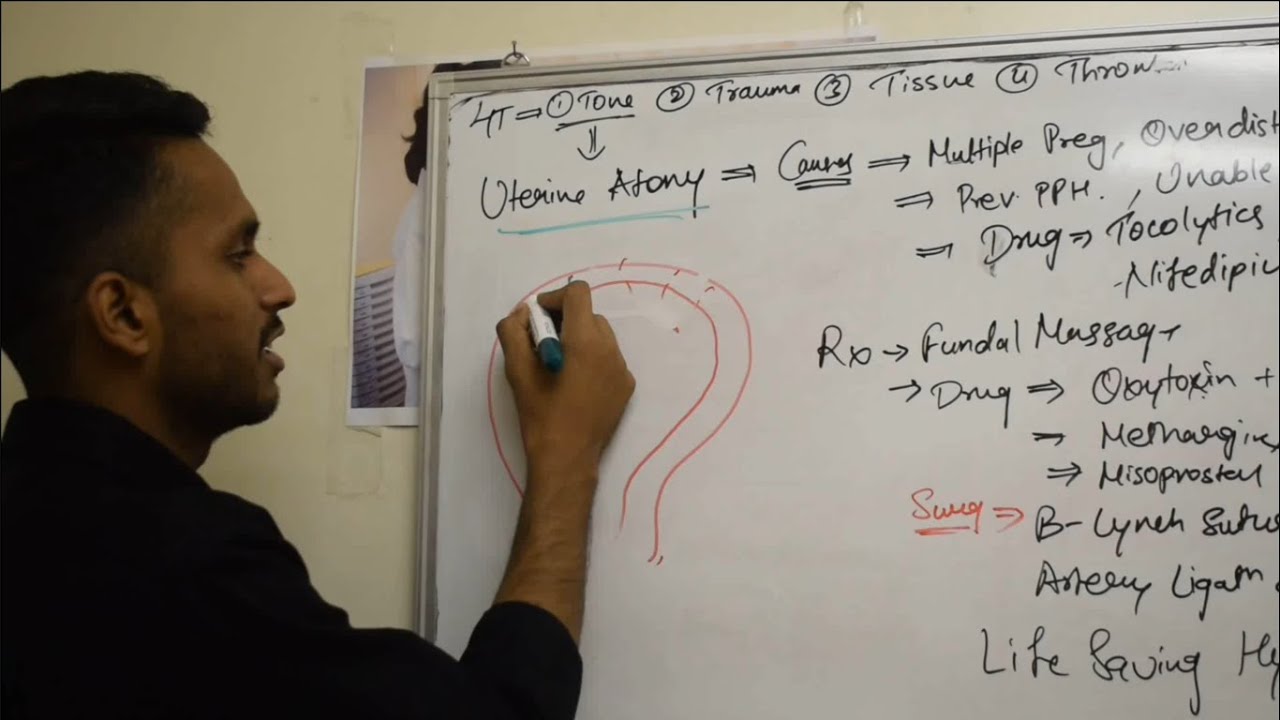 Postpartum hemorrhage | PPH | obg lectures