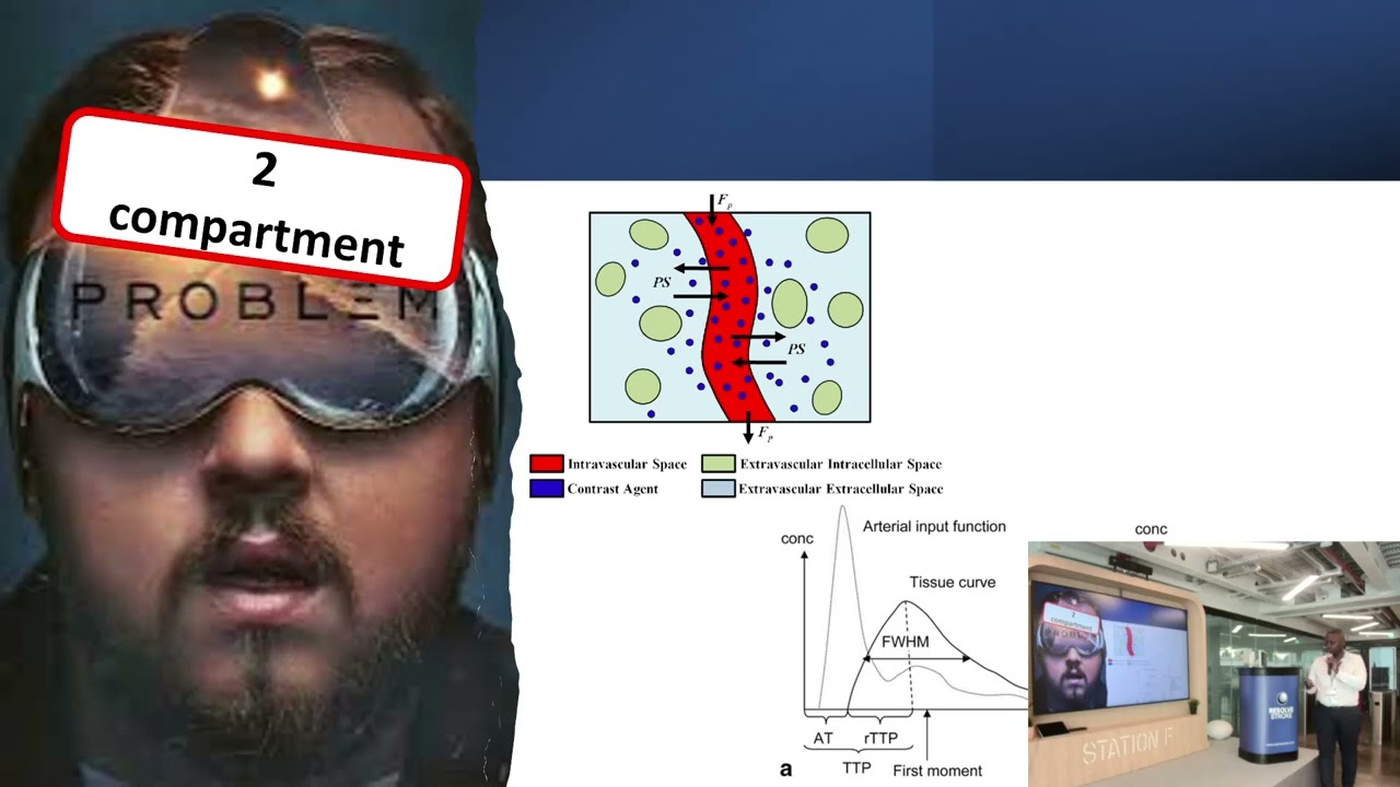 3D contrast enhanced acoustic angiography and perfusion imagery_Clément Gakuba_2025