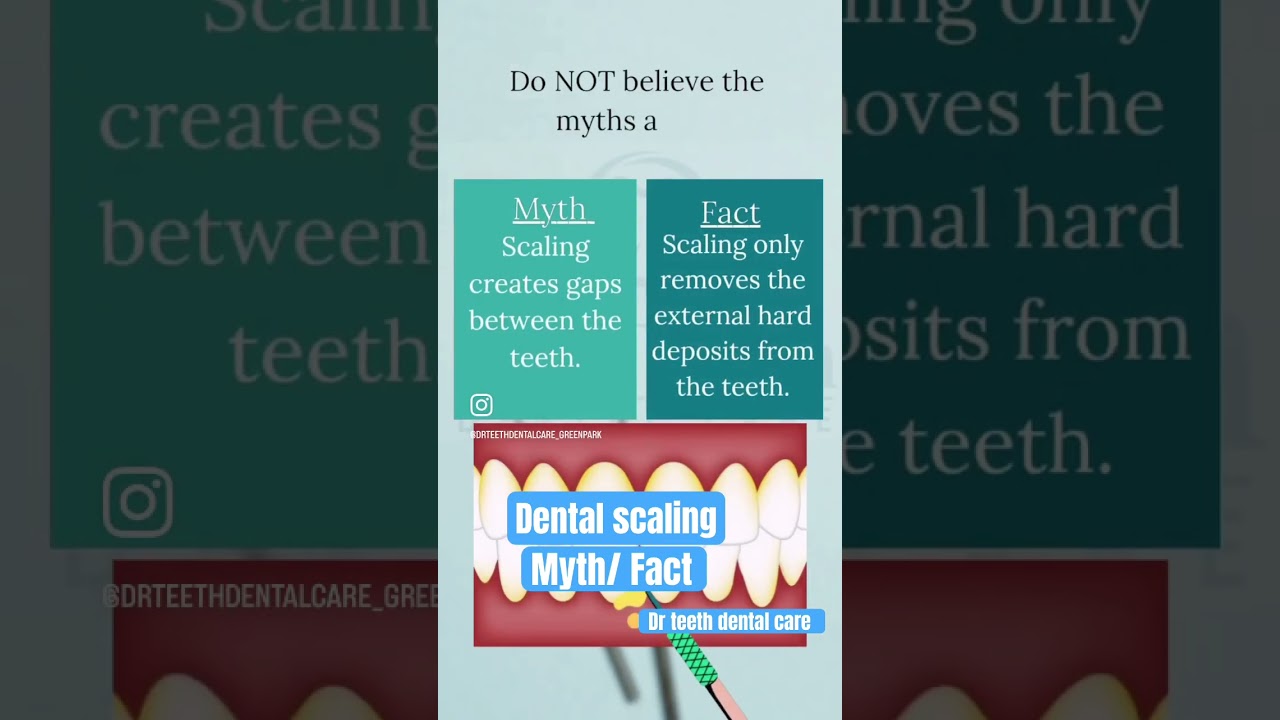 Dental scaling#dentist #toothcare #clearaligners #toothpain #dentalscaling #drteeth #shortvideo
