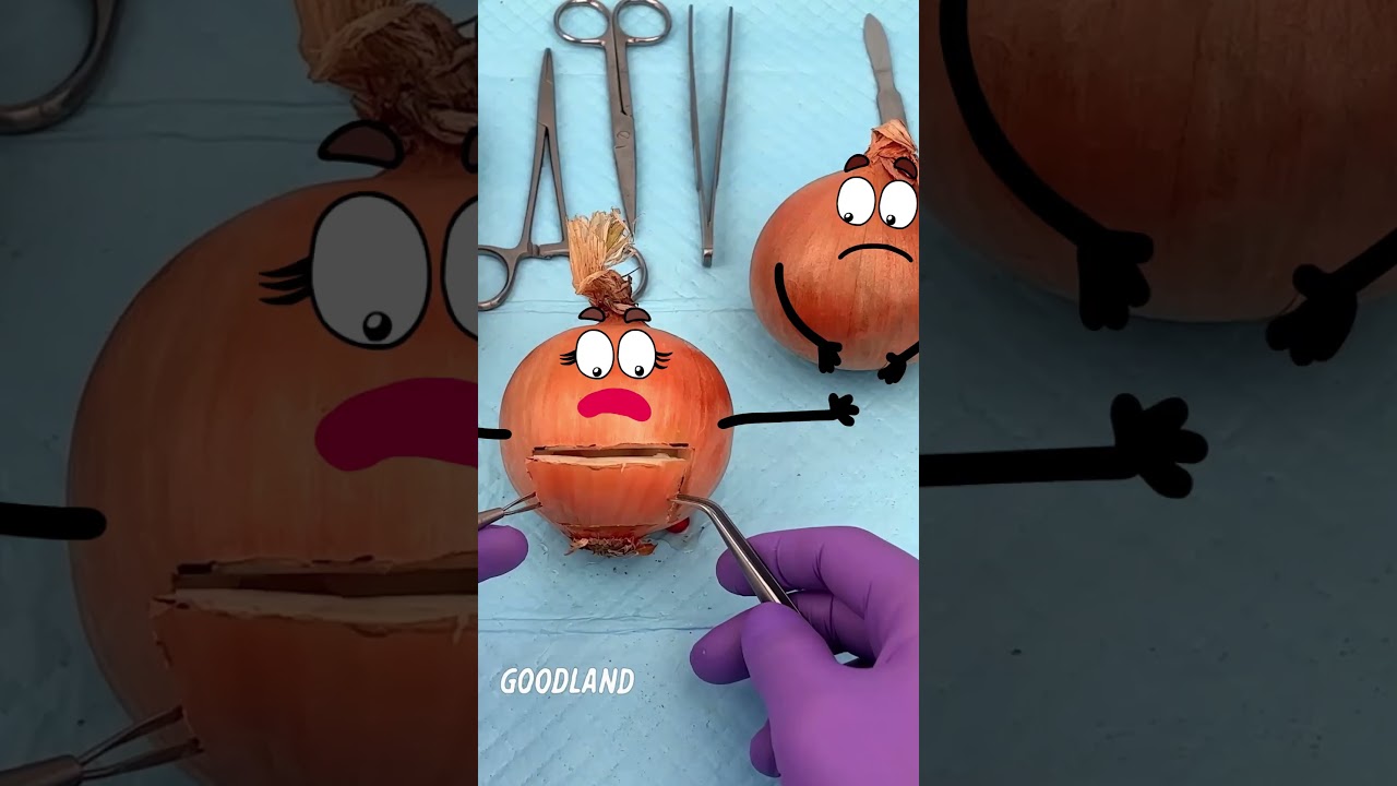 Goodland | Onion surgery, baby onions 😂 #cartoon #doodles #animation