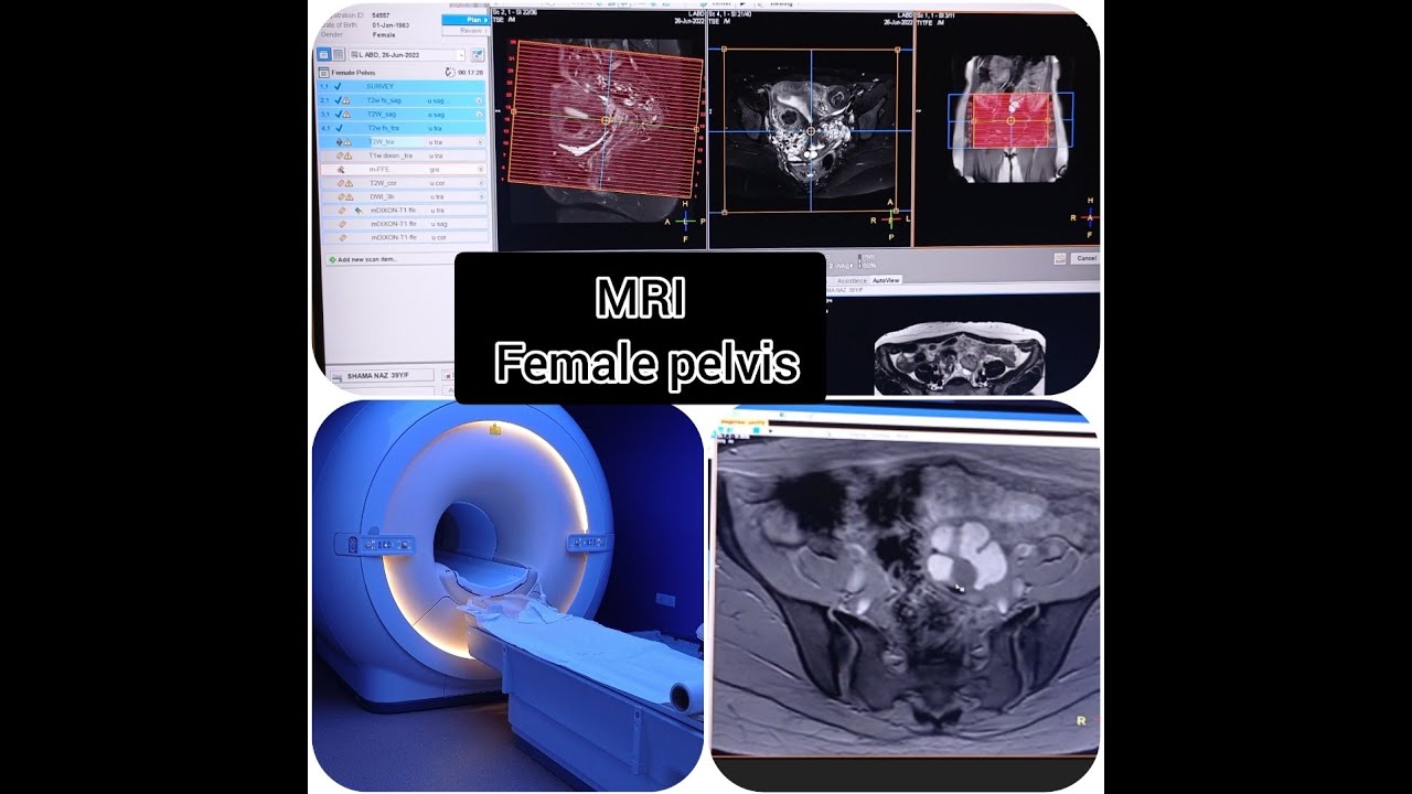 MRI Female pelvis planning and positioning
