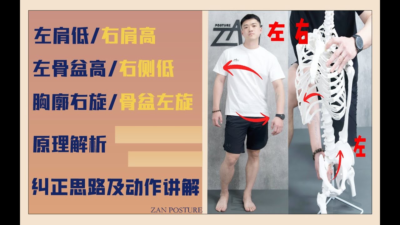 右肩高，左侧骨盆高，胸廓右旋，骨盆左旋的纠正方法