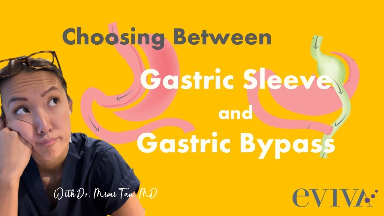Choosing between a gastric sleeve and a gastric bypass- with Dr Mimi Tan