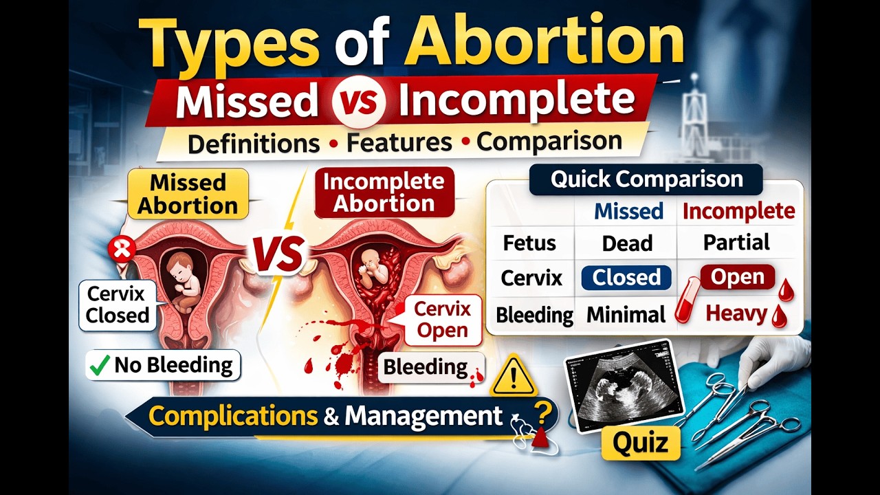 Missed vs Incomplete Abortion |Types of Abortion for MBBS & Nursing #abortionprocedure #gynaecology