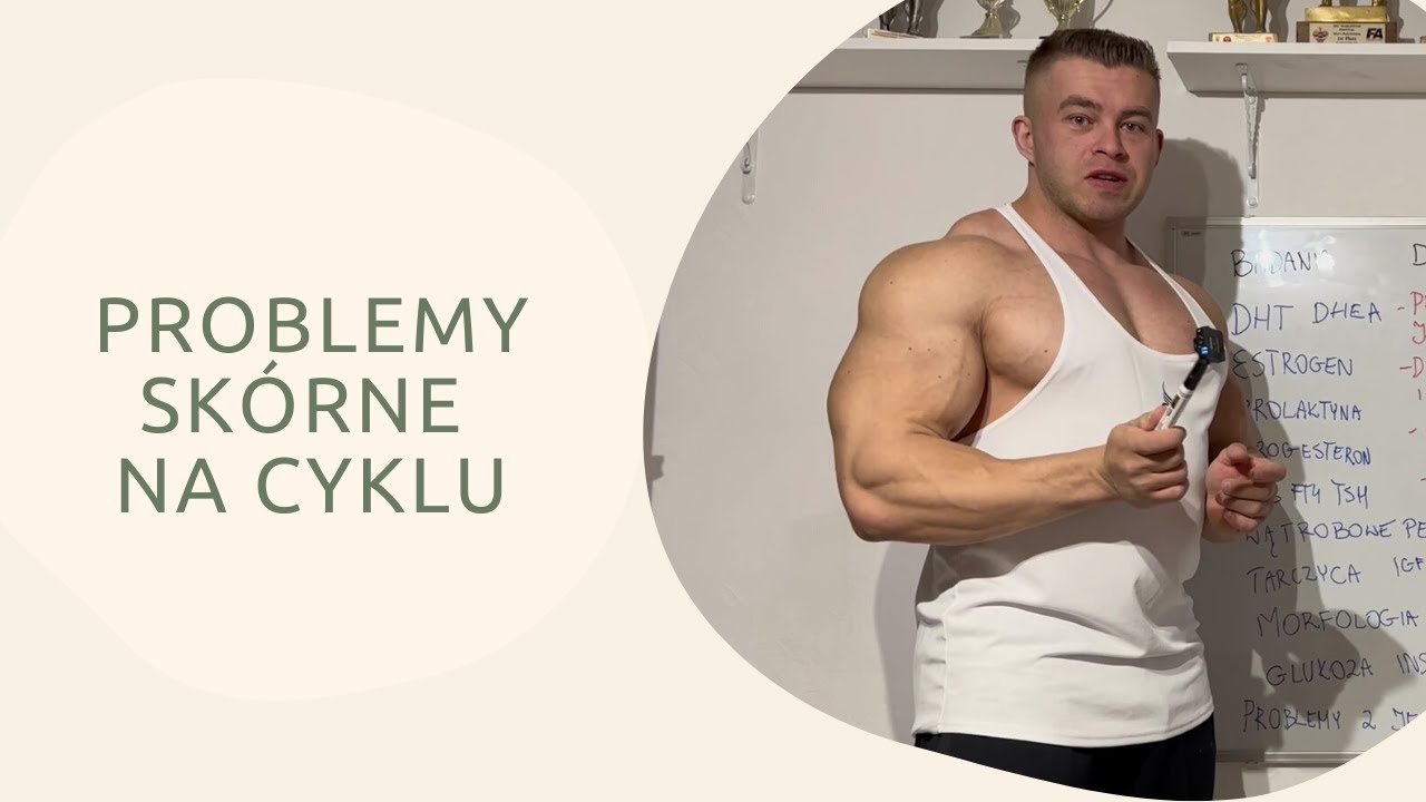 Trądzik pryszcze problemy ze sk&oacute;ra i cerą