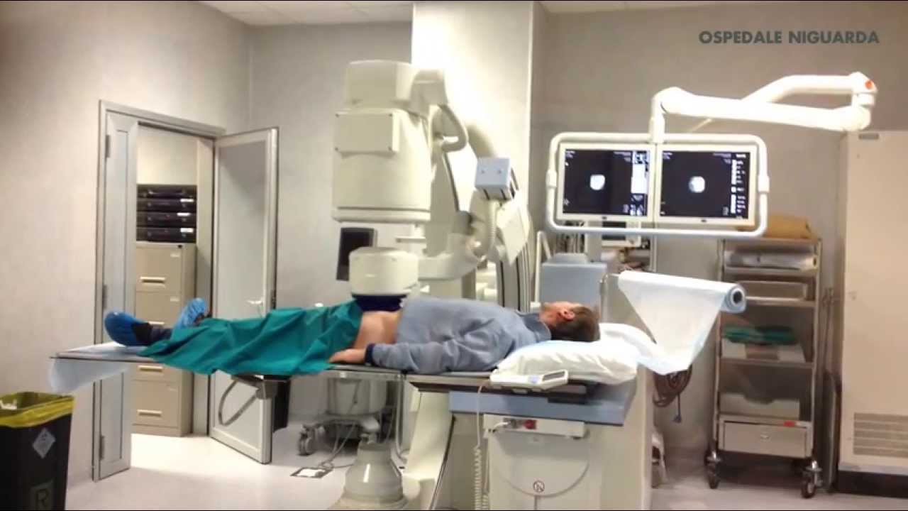 Litotrissia extracorporea ad onde d'urto