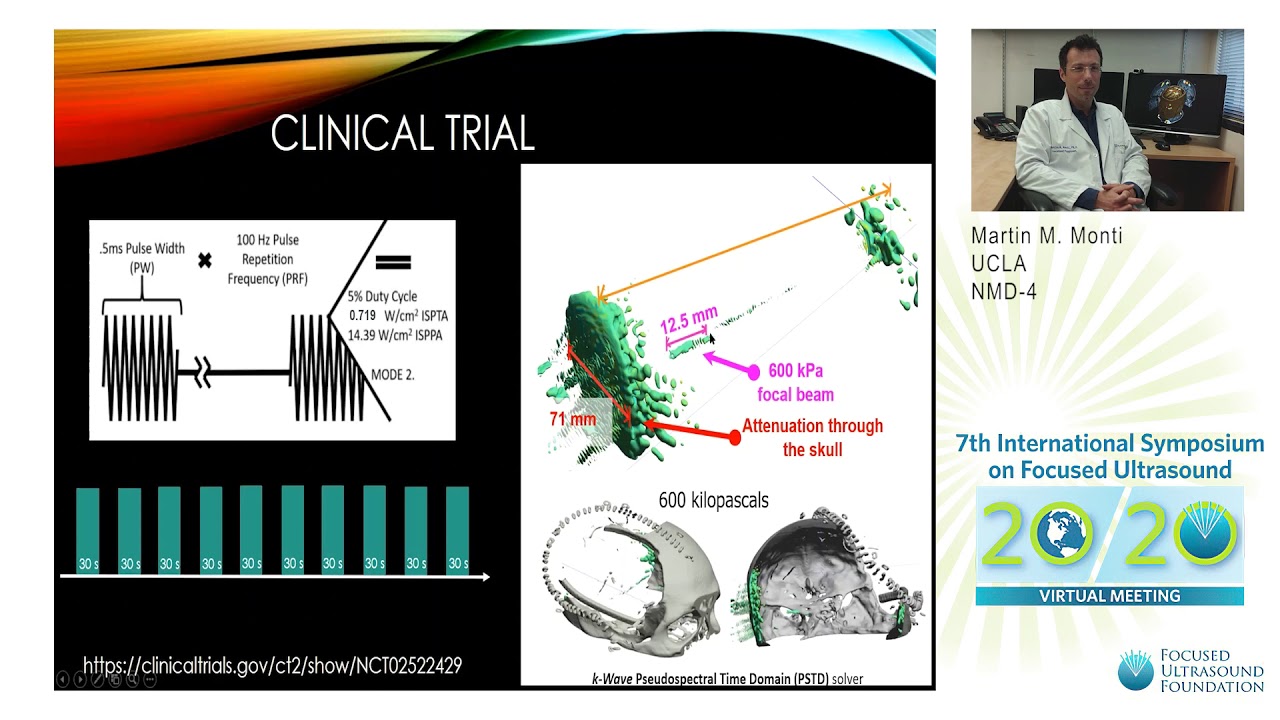 Martin Monti - Thalamic Low-Intensity FUS in Disorders of Consciousness (2020)