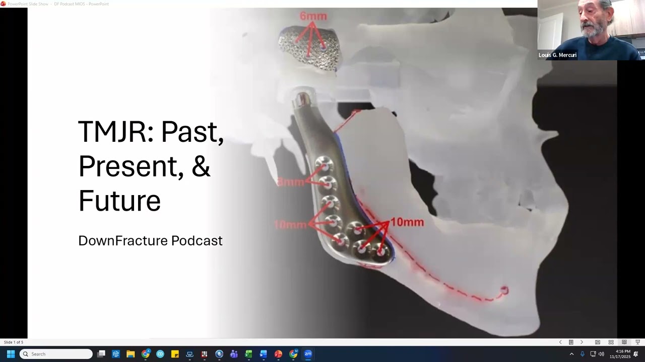 History of TMJ Replacement with Dr. Mercuri