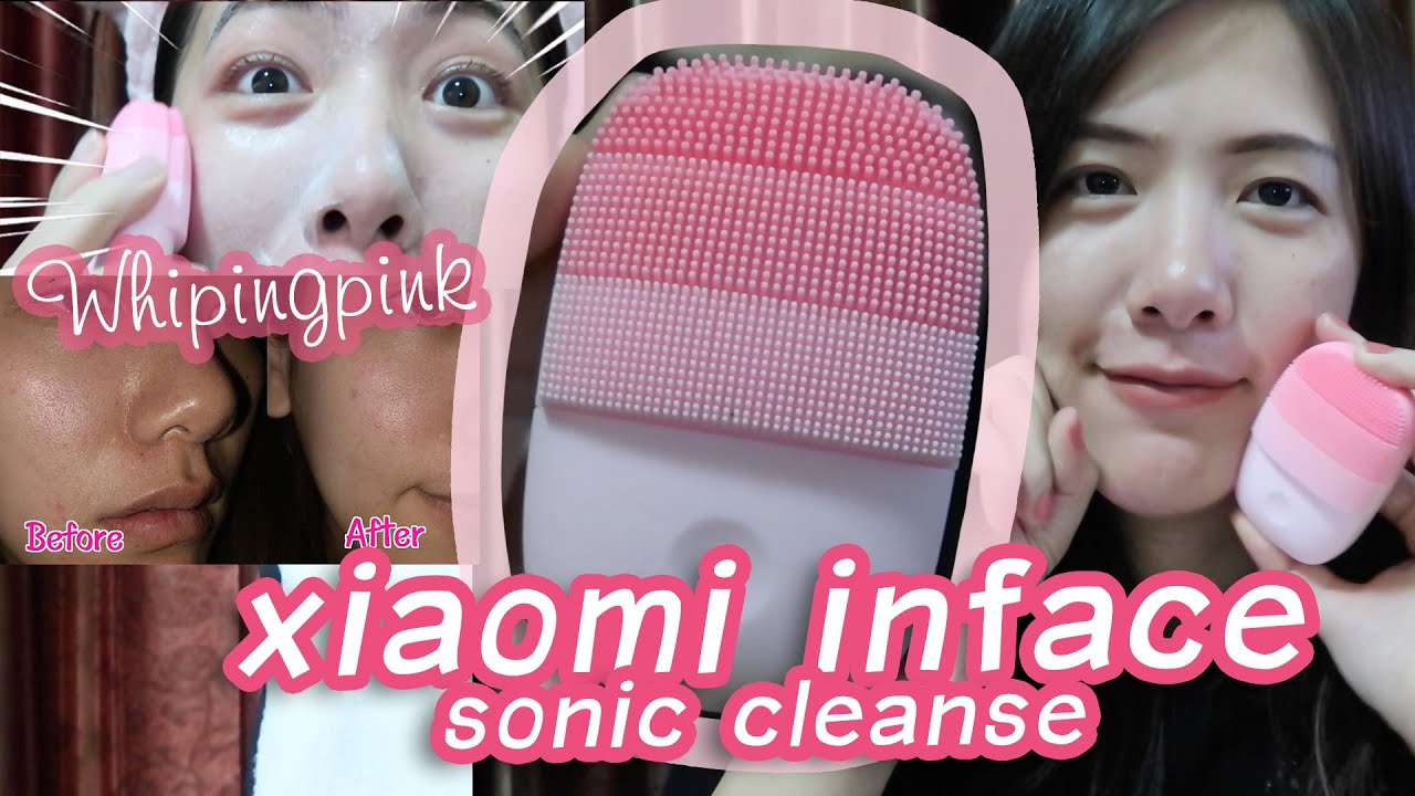 xiaomi inface รีวิวใช้จริง​ 1​ เดือน​Ep.1​(มีต่อEP.2 ใช้4 เดือนนะจ๊ะ) สิวหายเริ่มที่หน้าสะอาด
