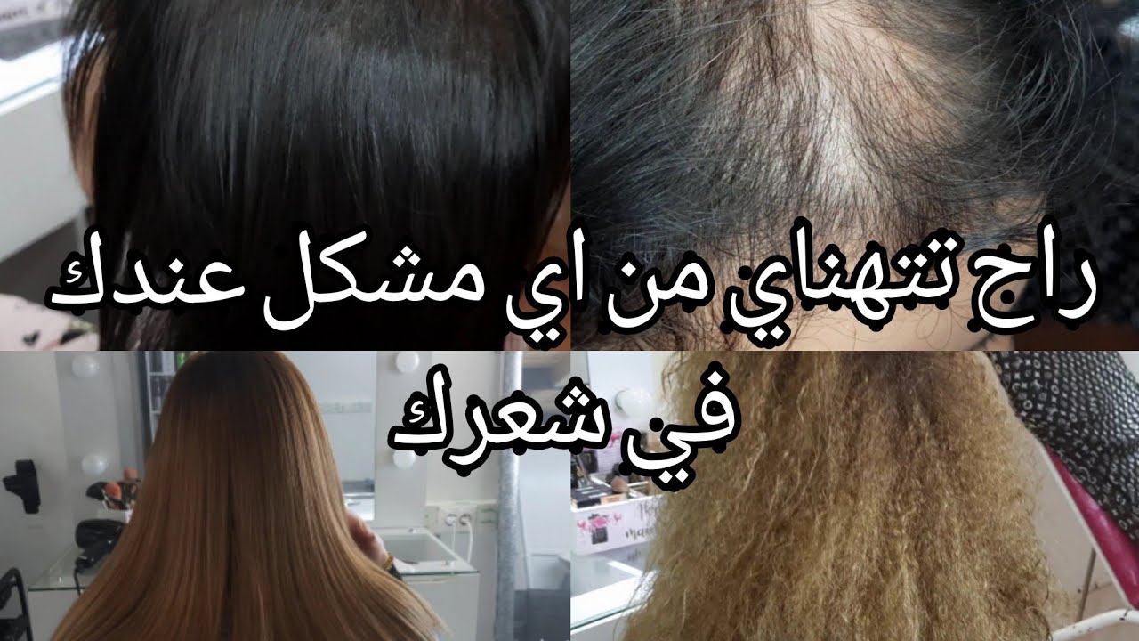 شعرك راح يرجع شباب وتتهناي من اي مشكل فيه من اول يوم(محروق فارغ ناشف حرش يطيح )
