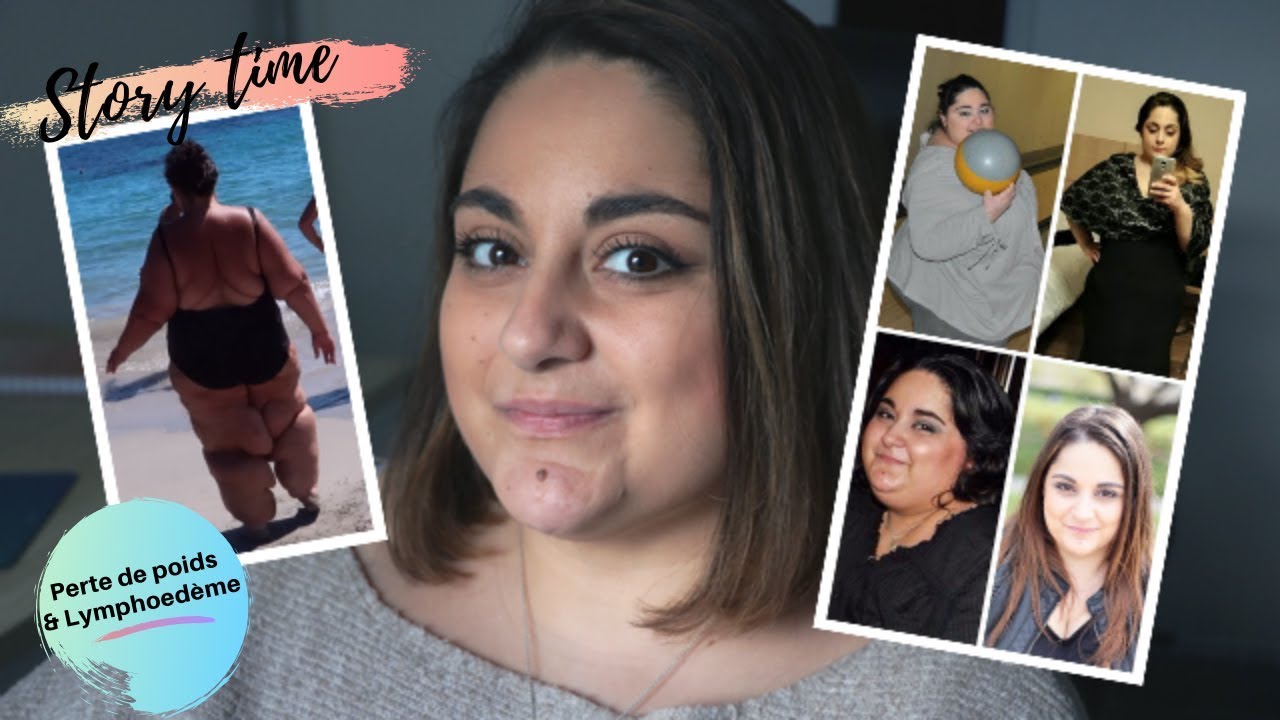 l STORY TIME l Perte de poids & lymphoedème : - 100 kilos quand soudain...