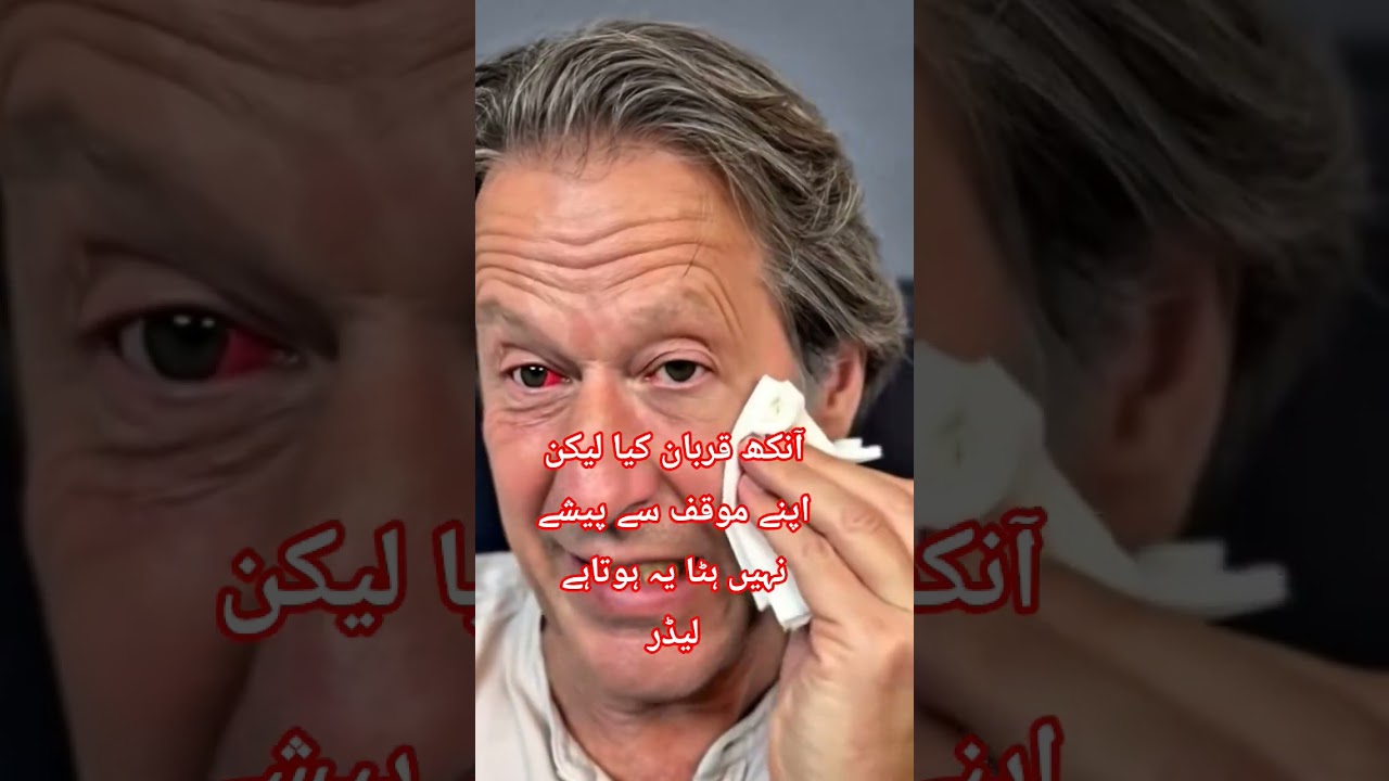 Imran Khan right eye #pti #imran khan viral