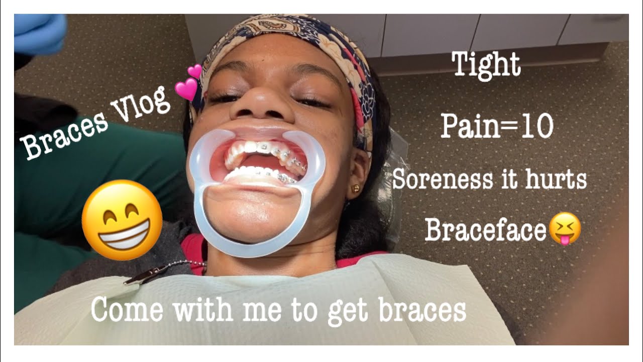 Braces Vlog: COME GET BRACES WITH ME😁💕