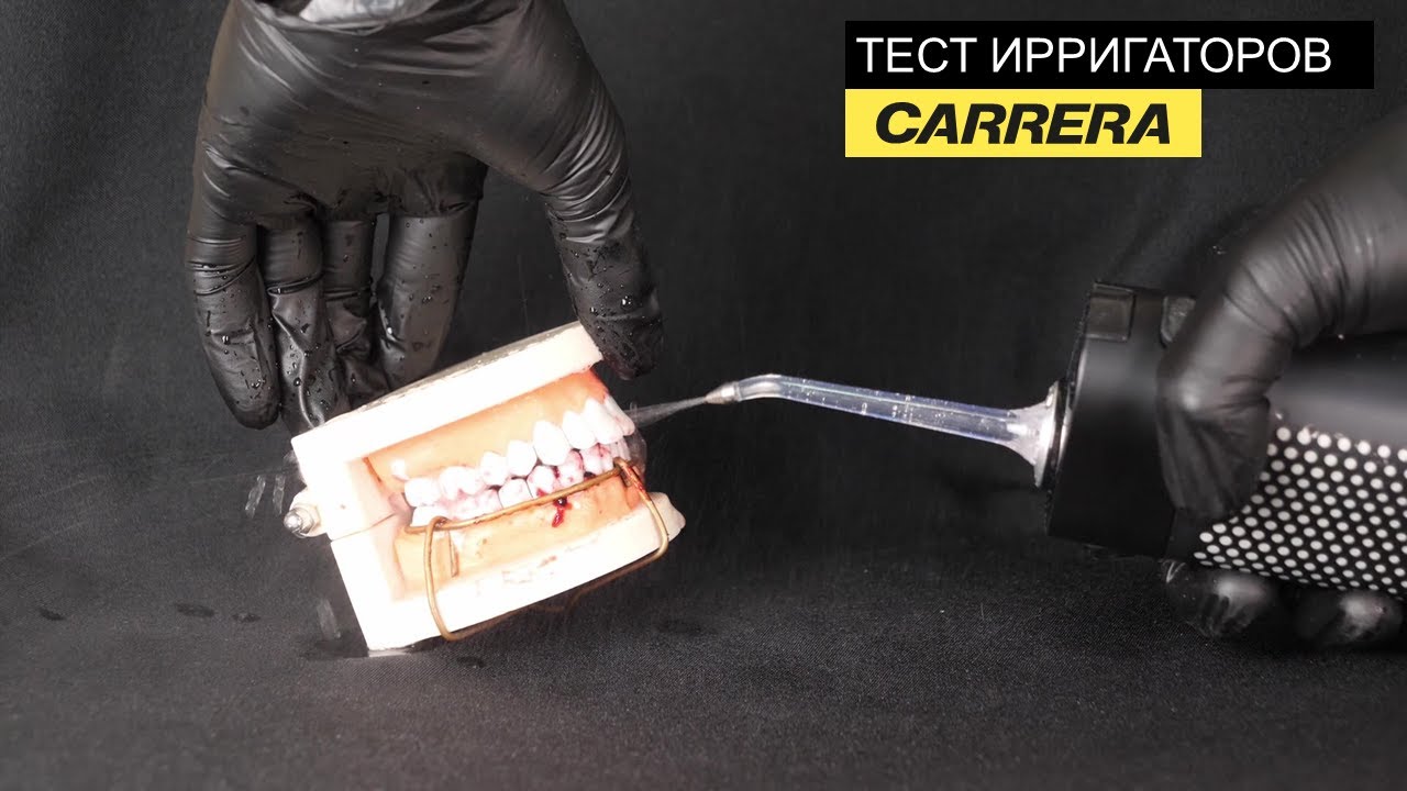Ирригаторы CARRERA  Тест моделей. Кому и для чего нужны ирригаторы.