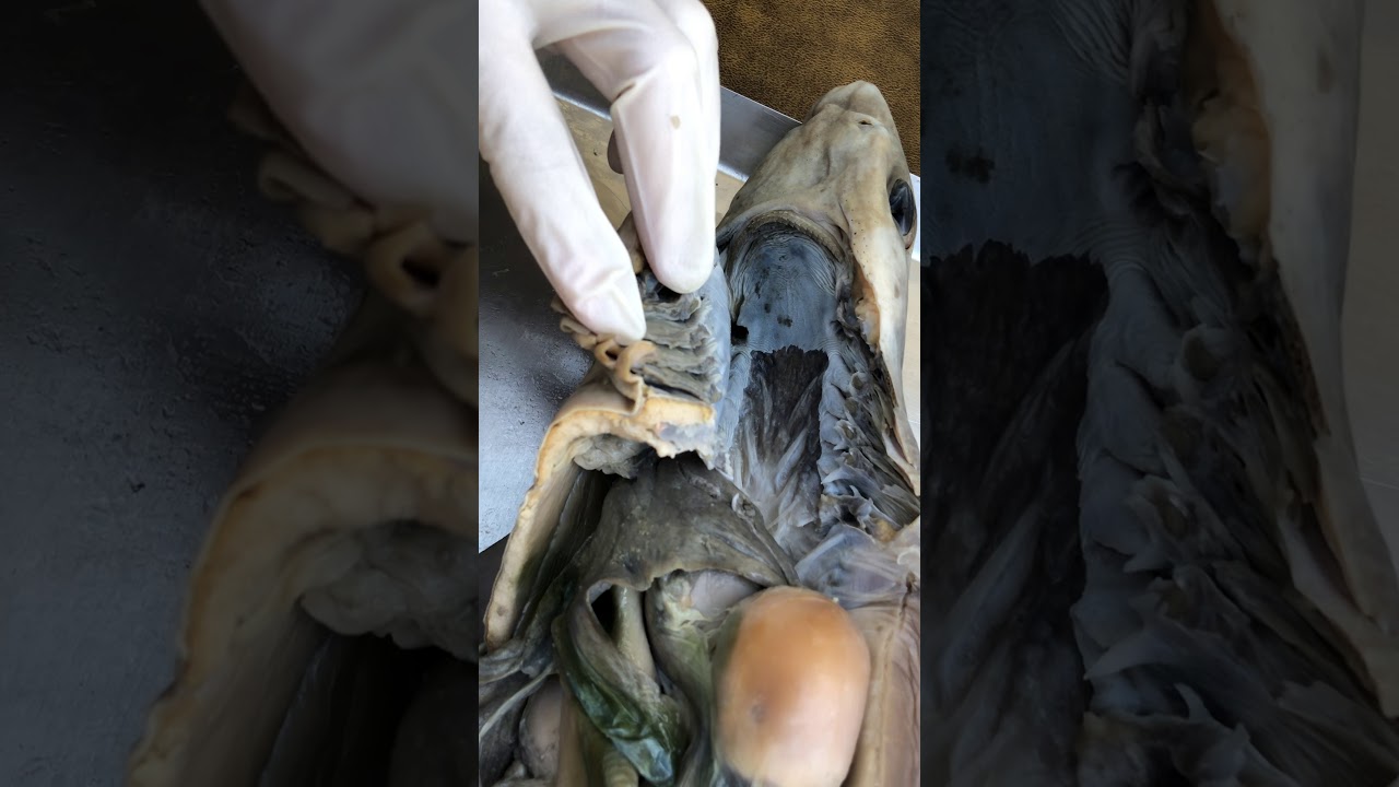 Shark Dissection 6: Circulation--Conus Arteriosis To Dorsal Aorta