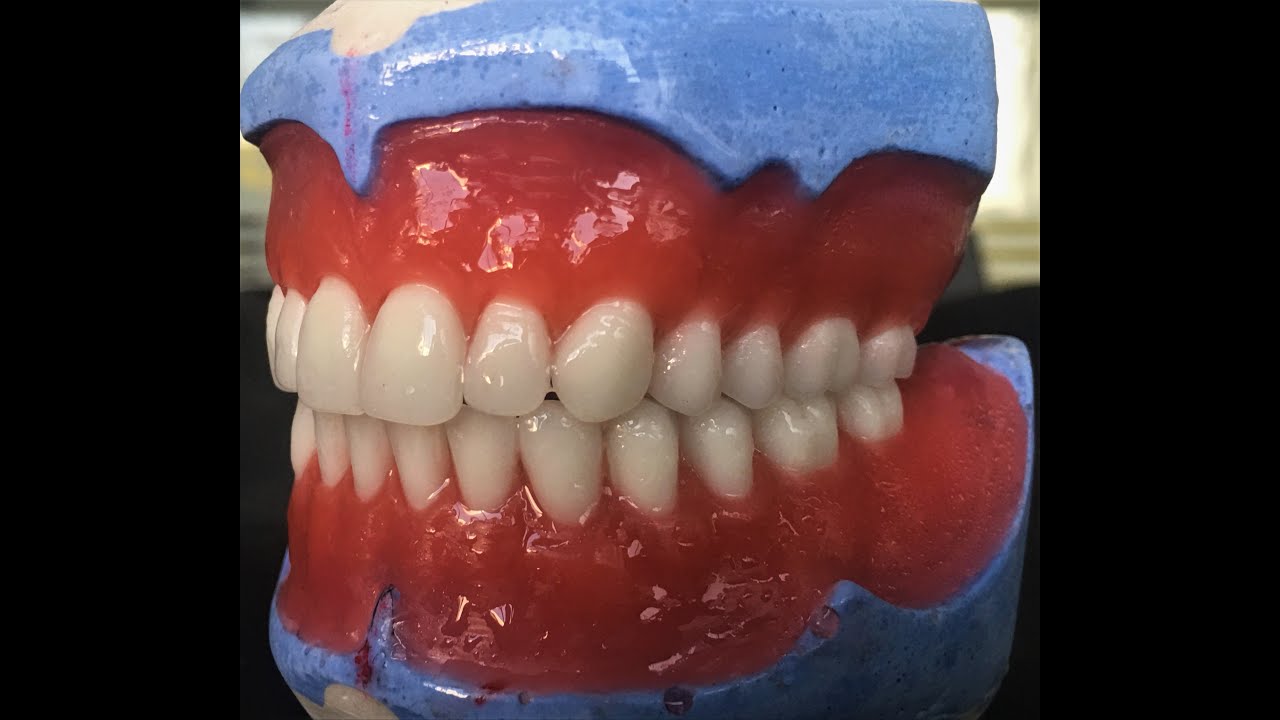 Total Protezlerde Diş Eti Modelajı-Wax Contouring of Complete Denture