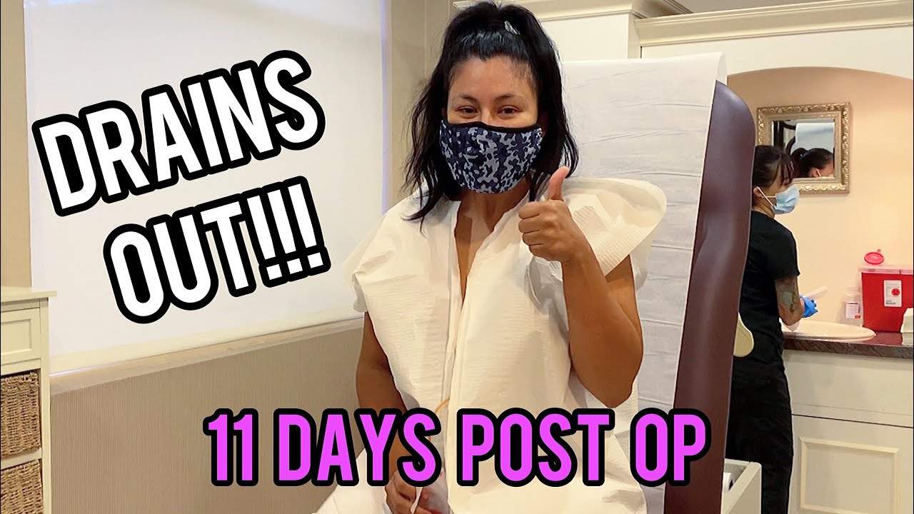 I GOT MY DRAIN REMOVED | TUMMY TUCK WITH DOC TANEJA EP. 5 | Alma Rivera Beauty