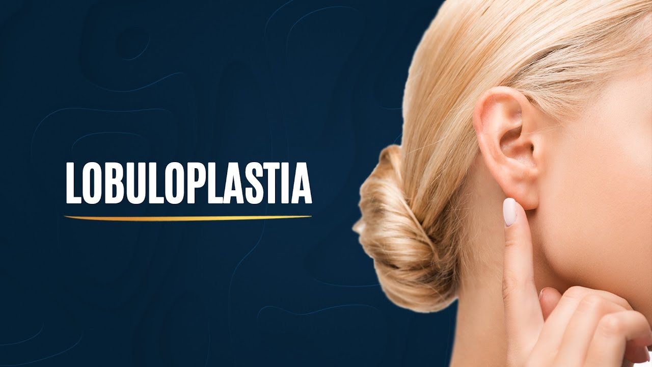 Lobuloplastia