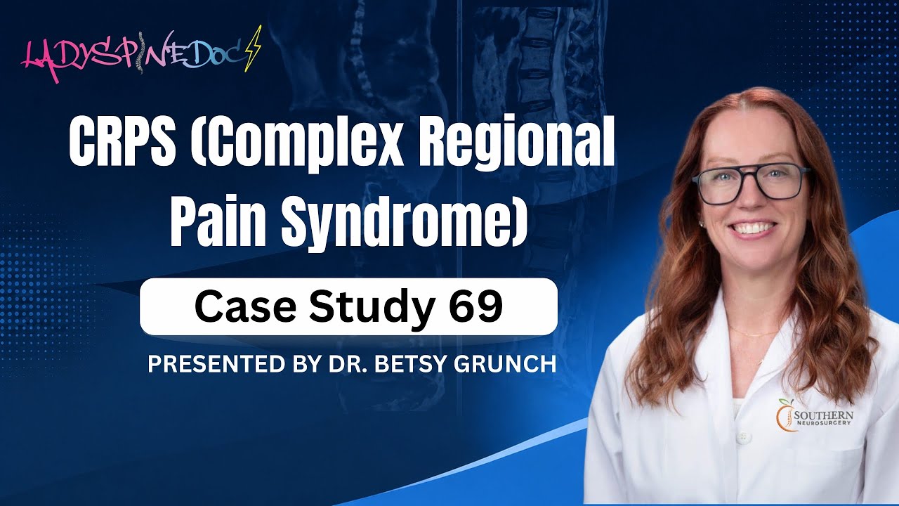 Case study 69 - CRPS (Complex Regional Pain Syndrome) Neurosurgeon explains Diagnosis & Treatment