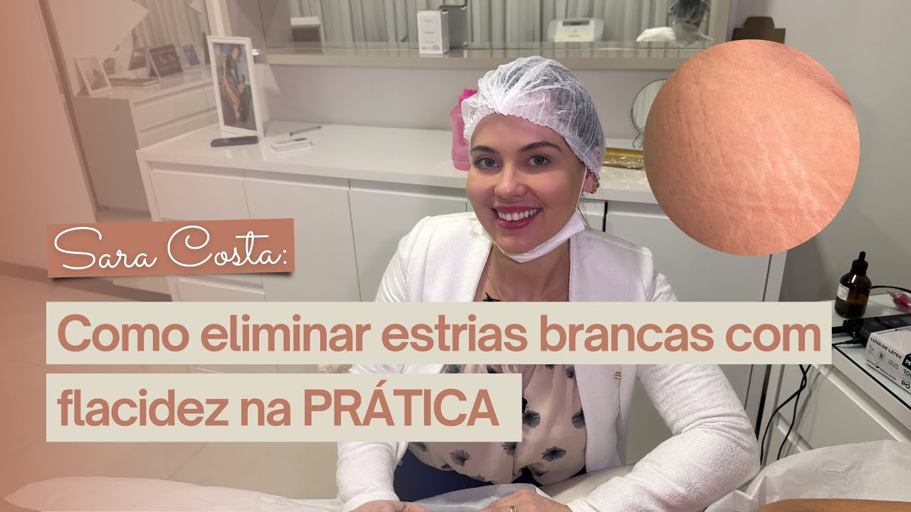 Como eliminar estrias brancas com flacidez na prática