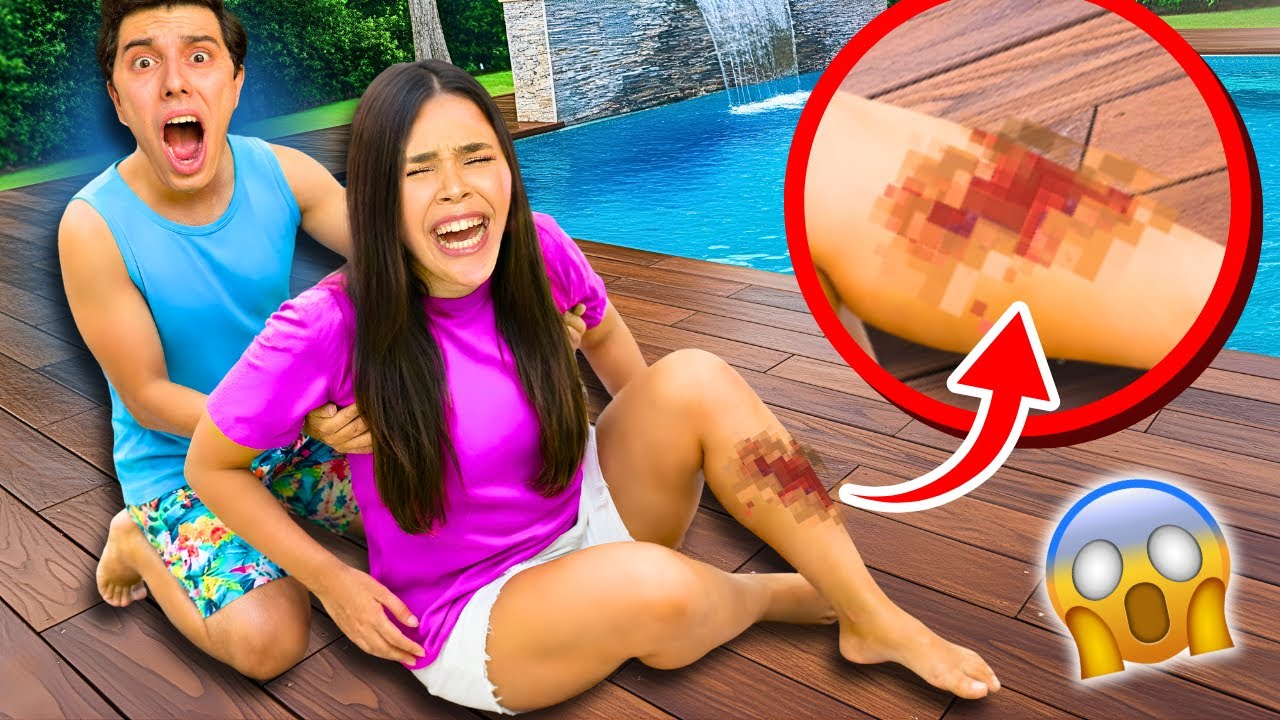 VICK SOFREU UM ACIDENTE NA PISCINA 😨