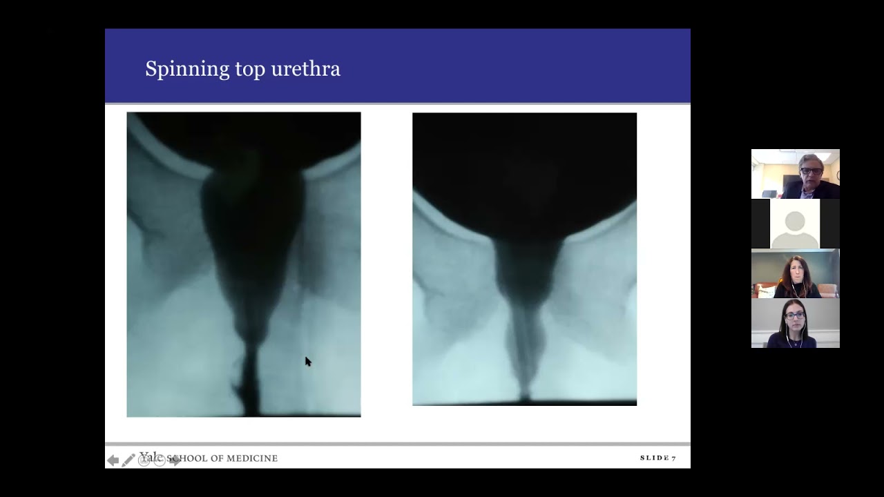 2021 Urology CME Series: Pediatric Bowel & Bladder Dysfunction