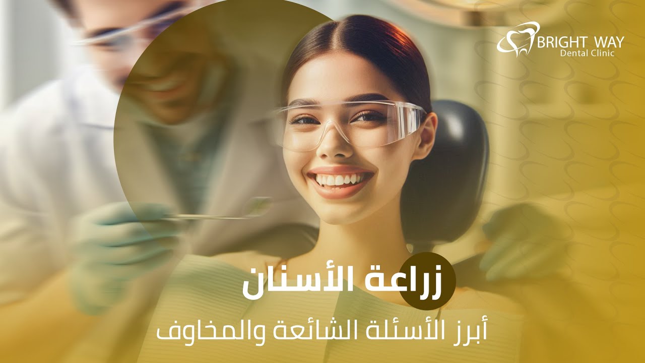 زراعة الأسنان: أبرز الأسئلة الشائعة والمخاوف