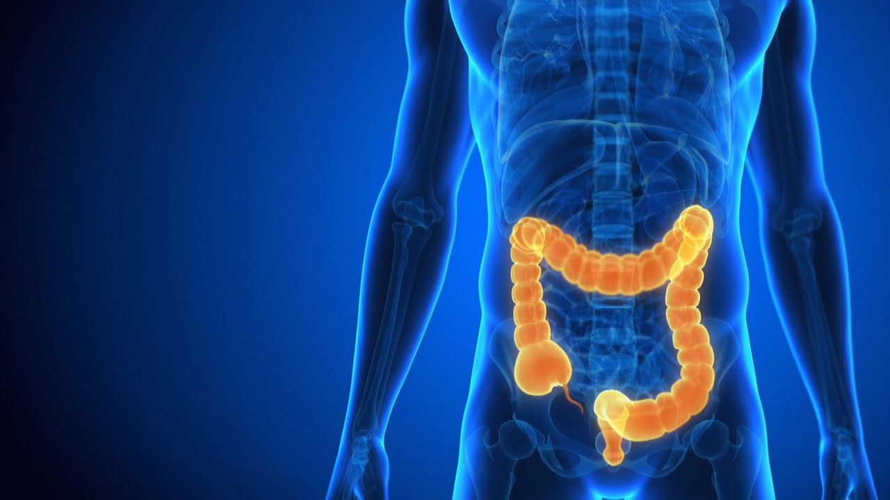 Eating Healthy with Crohn&rsquo;s Disease