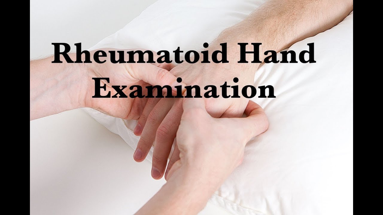 Rheumatoid Hand Examination by ASM Minds Team