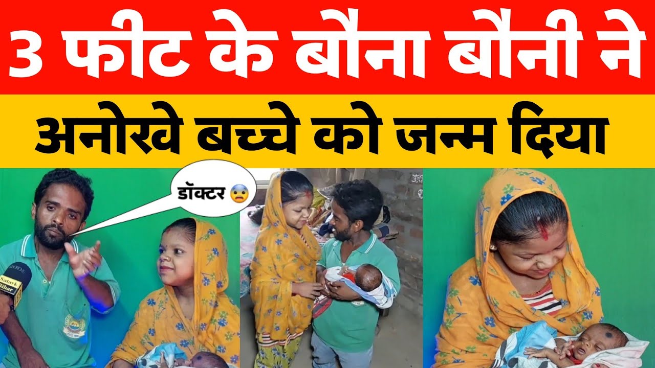3 फीट की मां 2 फीट के पिता ने दिया अनोखे बच्चे को जन्म । #chamatkar #liliput