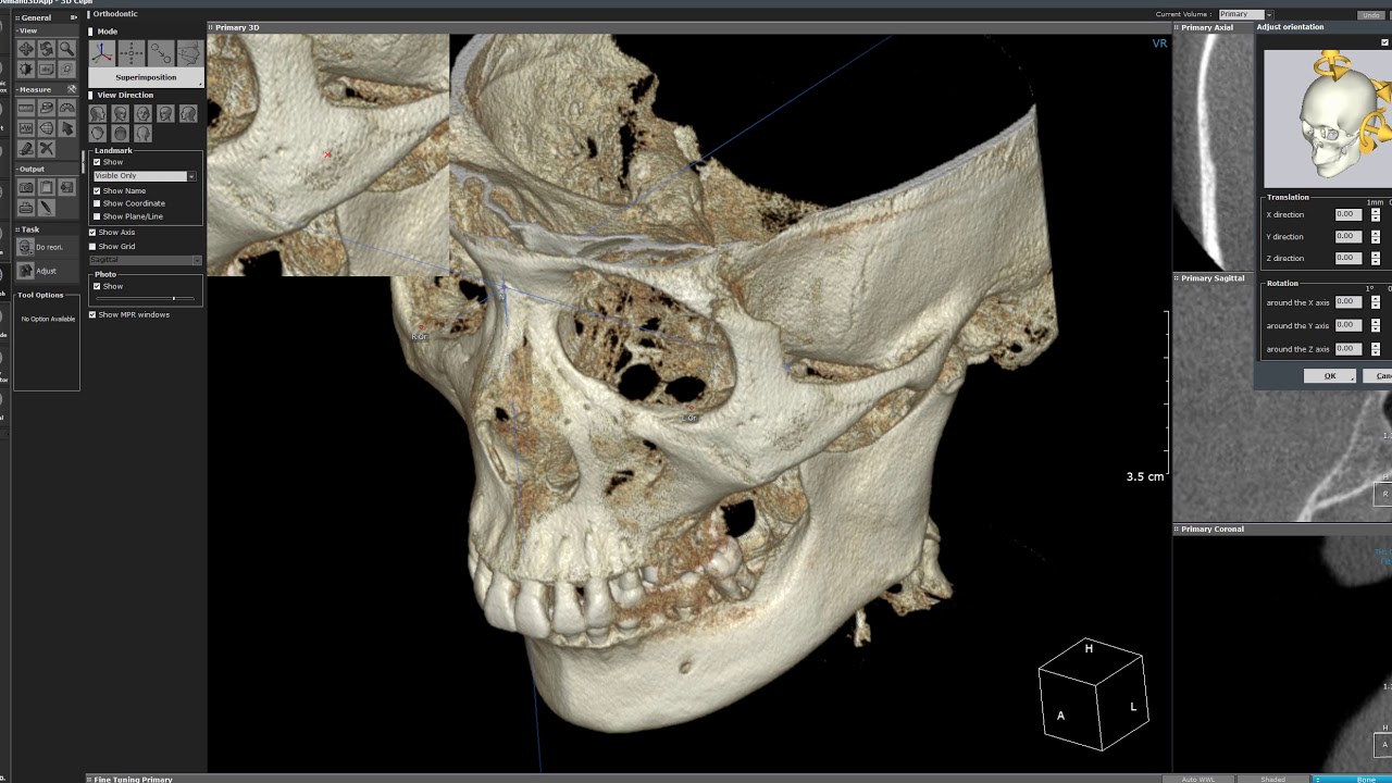 3D Ceph x-ray
