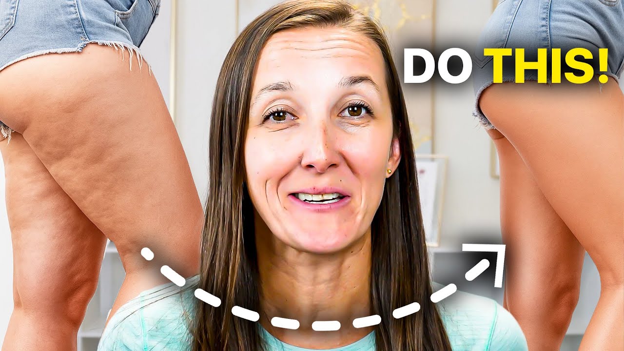 The Hidden Cause of Cellulite Nobody Talks About (how you can fix it)