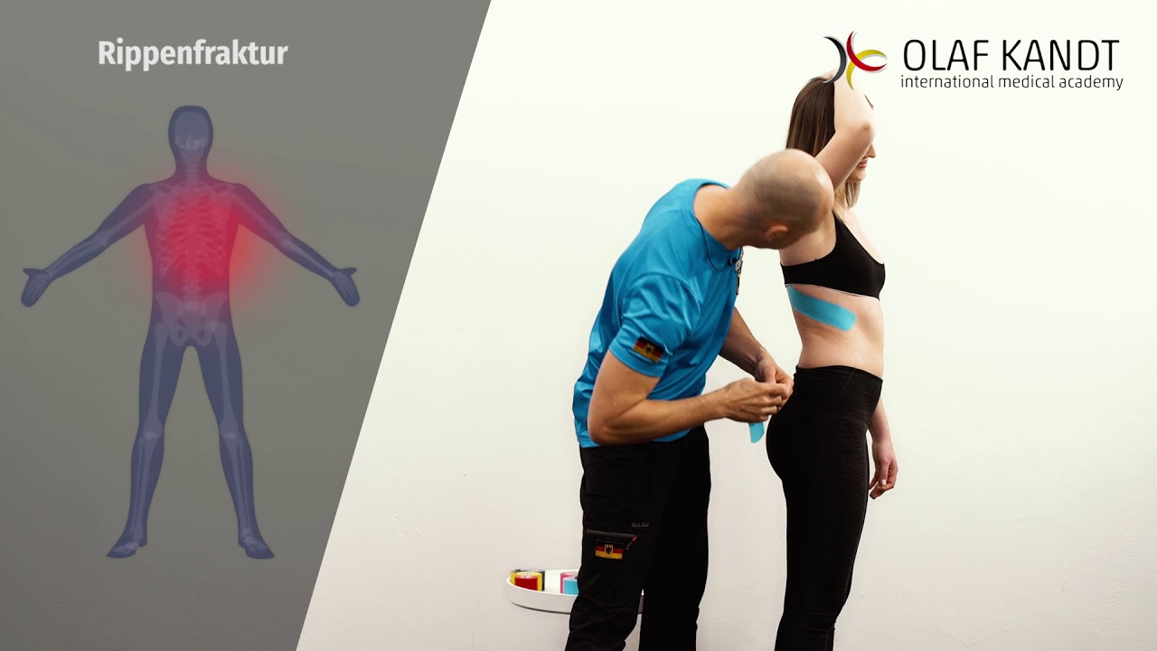 Rippenfraktur
